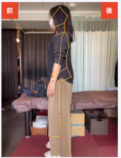 beforeの写真